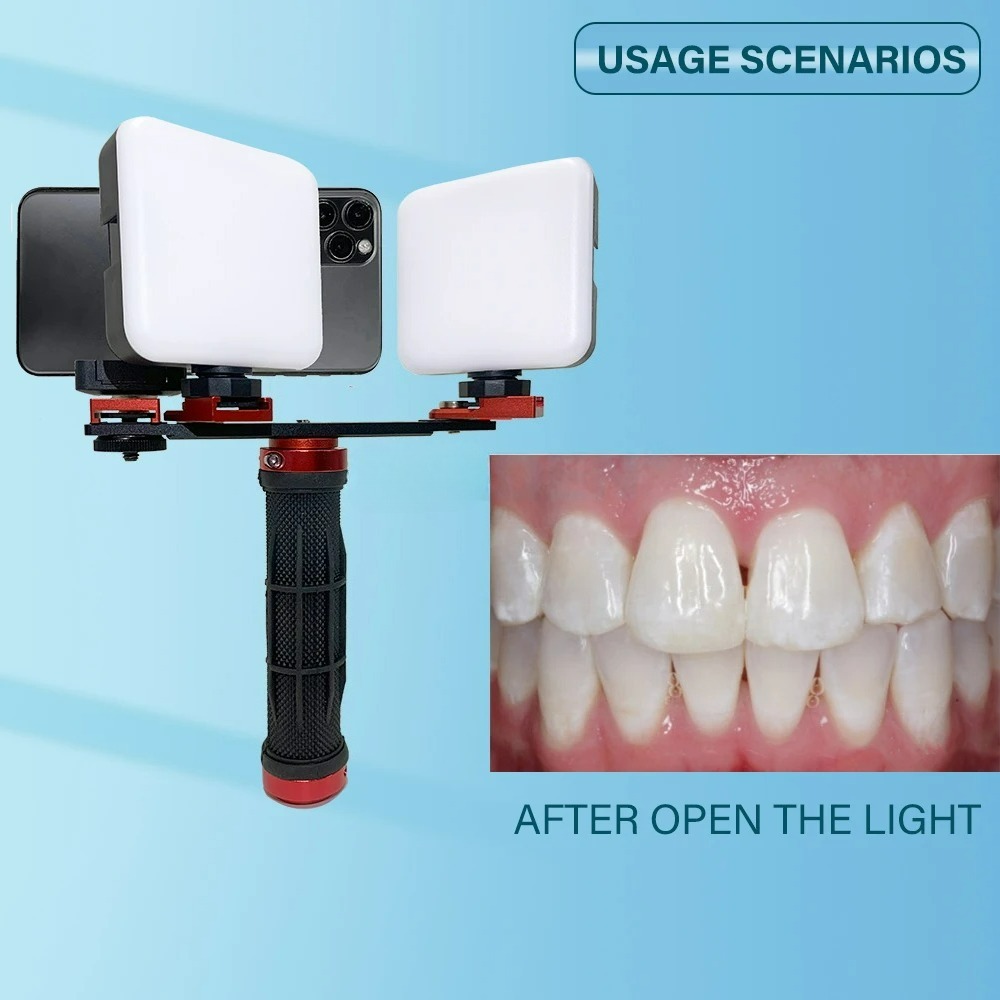 Dental Photography Light Phone - Phone Accessories For Photography recension och pris